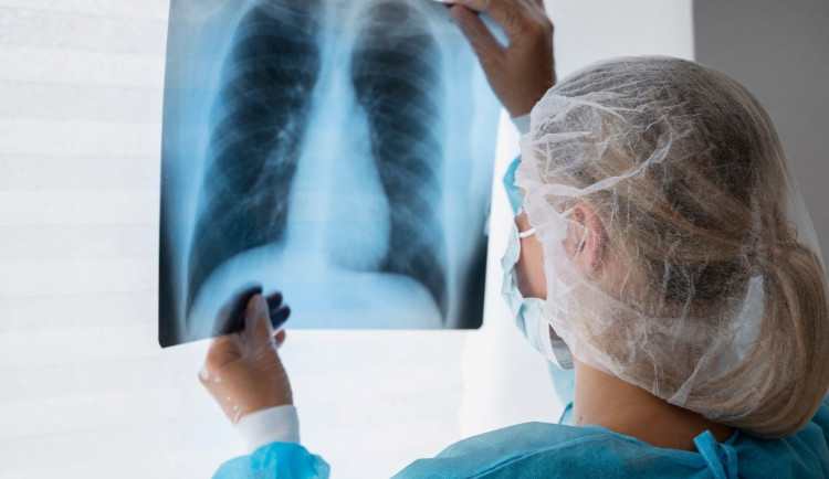 Pneumologové chtějí rozšířit genetické testování nádorů