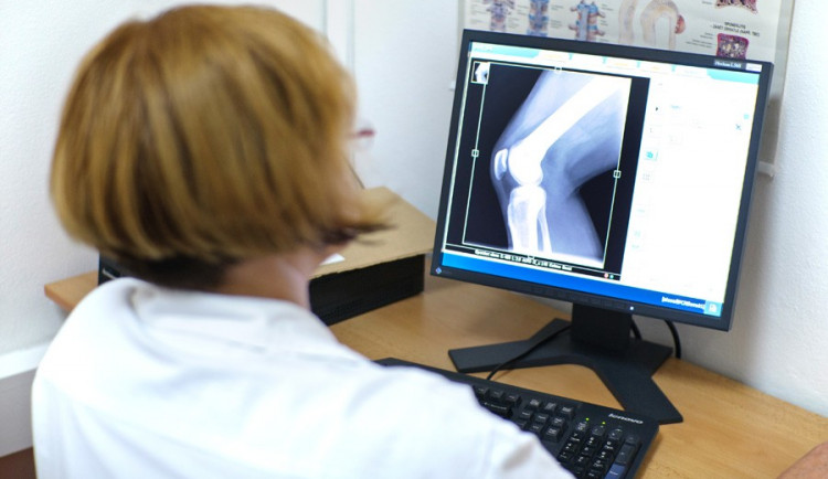 FOTO ilustrační - rentgen