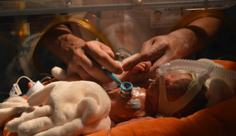 Lumír Kantor ošetřuje nedonošené dítě v inkubátoru