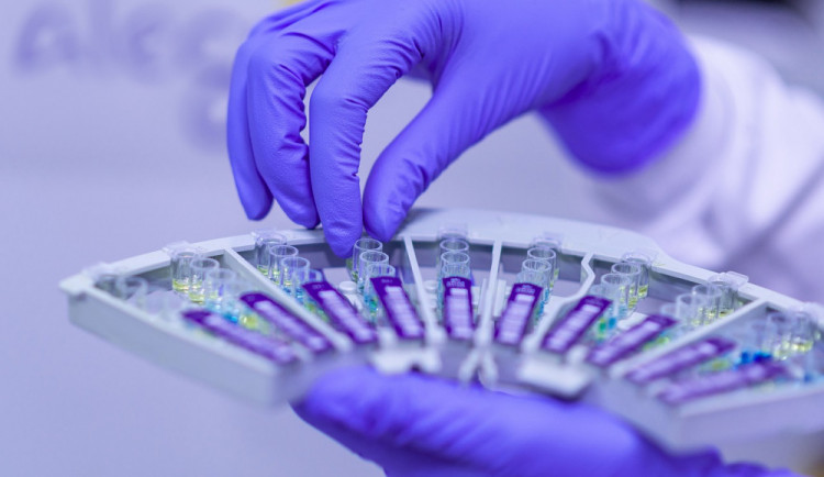 Počet nákaz koronavirem v Olomouckém kraji vzrostl. Přibylo 16 pacientů