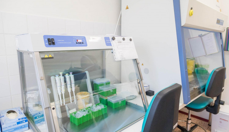 Tři nemocnice v kraji začnou od dnešního dne nově testovat na koronavir i samoplátce