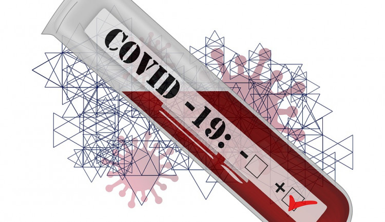 Nešel na testy, přesto mu přišla sms, že je pozitivní. Hoax, který se stal skutečností