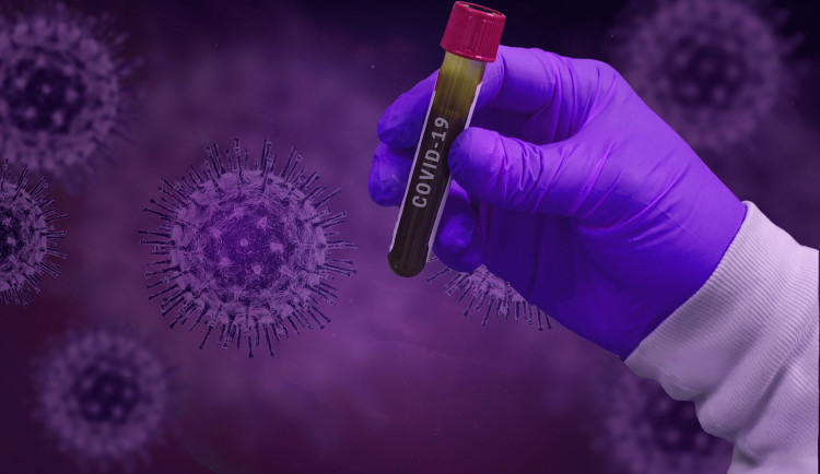 Olomoucký kraj se vrátil do pátého, nejvyššího stupně PES