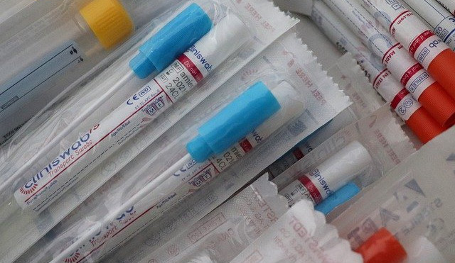 Kolik stojí antigenní testy v Lidlu, Penny nebo Albertu? Podívejte se na velký přehled