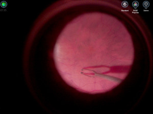 Nový operační systém usnadní jemnou práci lékařů z olomoucké oční kliniky