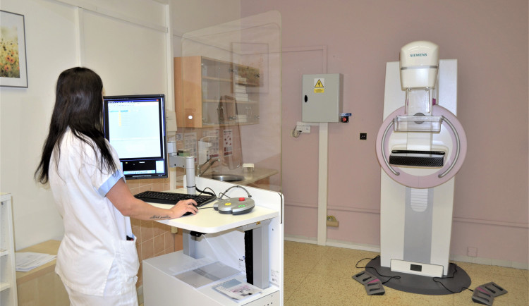 Nový mamograf v Nemocnici AGEL Prostějov