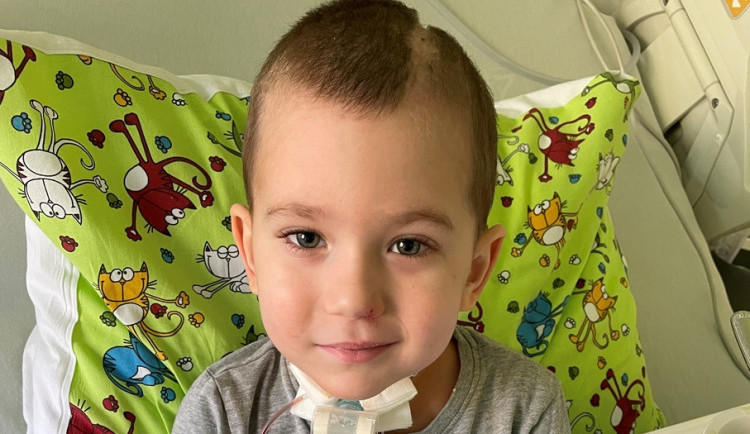 size3-16373286840768-152-maly-eddie-prodelal-bezpriznakovy-covid-nasledkem-bylo-krvaceni-do-mozku-k-tomu-obrna-hlasivek