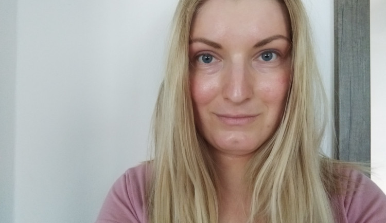 size3-16527102054919-2-atopicky-ekzem-se-mi-objevuje-temer-po-celem-tele-nejhorsi-je-stres-rika-veronika-seberova