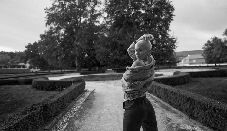 size3-16662716740746-239-behem-dvou-tydnu-jsem-prisla-o-vsechny-vlasy-pomaha-mi-o-alopecii-mluvit-rika-bara-kropackova