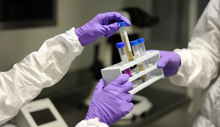 size4-16421971620614-124-size3-16398306004675-60-v-patek-pribylo-nejmene-pripadu-koronaviru-ve-vsedni-den-od-zacatku-listopad