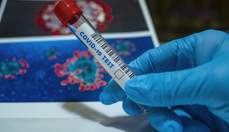 Přes svátky covid centrum v Hradci zavře, je upravená otevírací doba