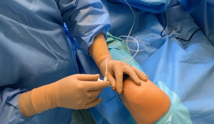 Nanoskopie představuje šetrnou diagnostickou i léčebnou metodu