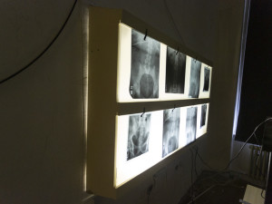 Loučení s nejstarší budovou olomoucké nemocnice. Nahradí ji superpavilon za čtyři miliardy