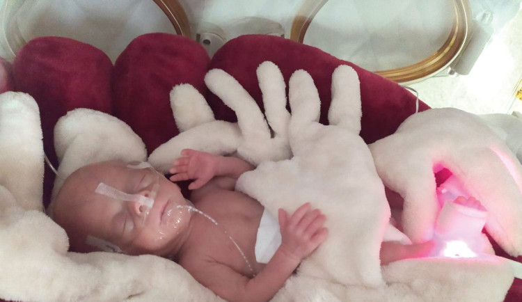 VIDEO: Nejmenší olomoucké miminko se vešlo do dlaně. Dnes má Vaneska velkou šanci na zdravý život