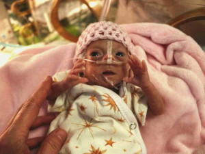 VIDEO: Nejmenší olomoucké miminko se vešlo do dlaně. Dnes má Vaneska velkou šanci na zdravý život