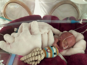 VIDEO: Nejmenší olomoucké miminko se vešlo do dlaně. Dnes má Vaneska velkou šanci na zdravý život