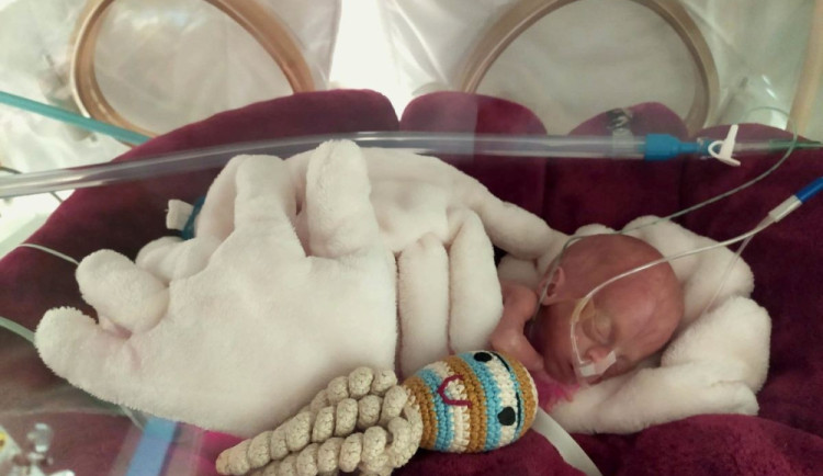 VIDEO: Fakultní nemocnice ukázala, jak náročná je péče o miminka do dlaně