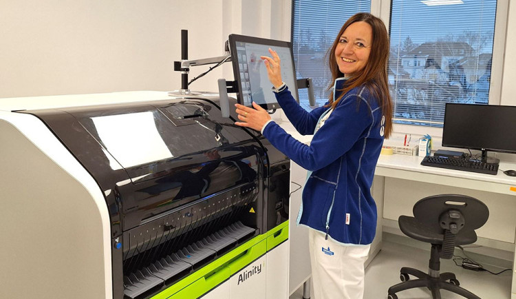 Laborantka Transfúzní služby Šumperk testuje systém - ilustrační foto