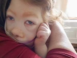 Syn má poškozený mozek a nedožije se rána, řekli Tereze po porodu. Míša teď oslaví tři roky a mamince dává velkou sílu