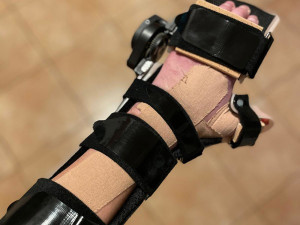 3 - Ruka visela už jen na kousku zápěstí. Díky specialistům z FN Olomouc může mladý hasič opět pomáhat v nouzi