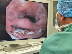 2 - Kovová tyč probodla při pádu muži z Přerovska obě plíce