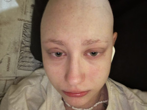 3 - Dva roky boje s leukémií. Tereza z Olomoucka je vděčná za pomoc nejen zdravotníkům z FN Olomouc