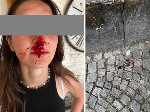 Teror mládeže ve Šternberku? Město řeší konflikty, po surovém útoku musela dívka do nemocnice