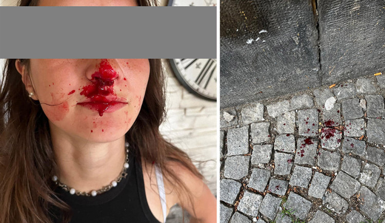 Napadení nezletilé dívky ve Šternberku vyšetřuje policie, město řeší dlouhodobé nevhodné chování skupiny obyvatel