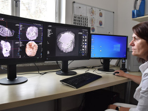 CT přístroj v přerovské nemocnici pomohl archeologům. Odtajnil cenný obsah tři tisíce let staré nádoby