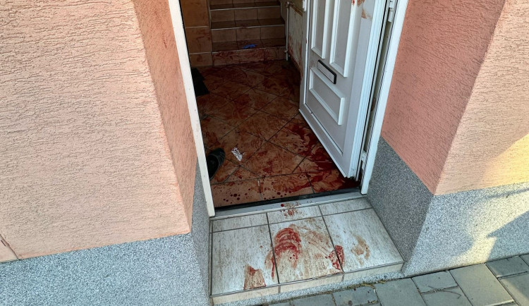 Tři cizinci se porvali před ubytovnou v Brně, všichni skončili v nemocnici