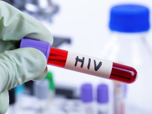Olomoucké centrum HIV má za letošek už 11 pacientů s AIDS. Existuje prevence, nabádají lékaři