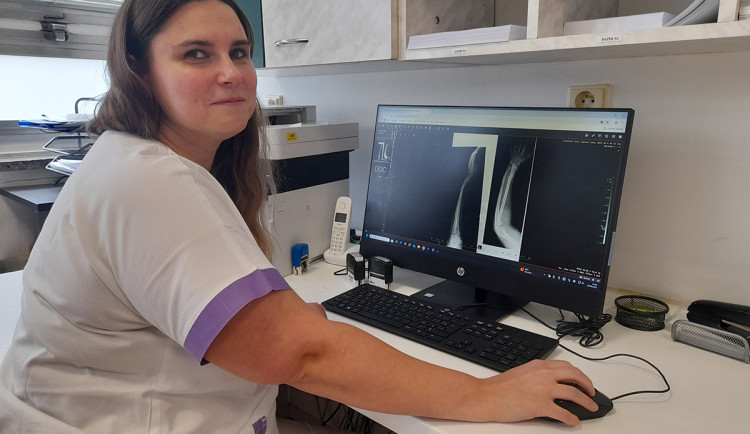 Veronika Schwarzerová, vedoucí sestra chirurgické ambulance Nemocnice AGEL Jeseník