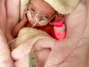 VIDEO: Viktorka se vešla do dlaně, po porodu ve Fakultní nemocnici měla 386 gramů. Dnes prospívá