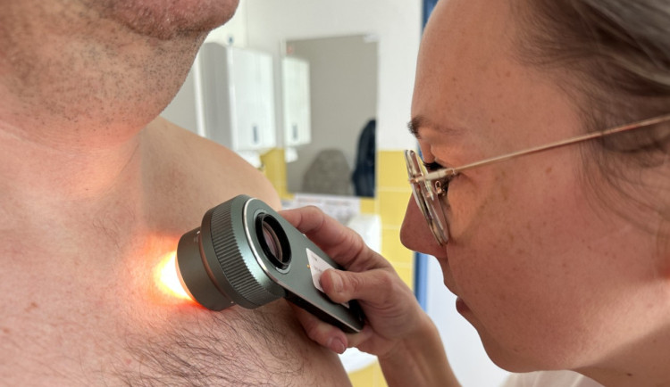 Den zdraví: Jihlavská nemocnice nabízí třeba i bezplatné vyšetření znamének