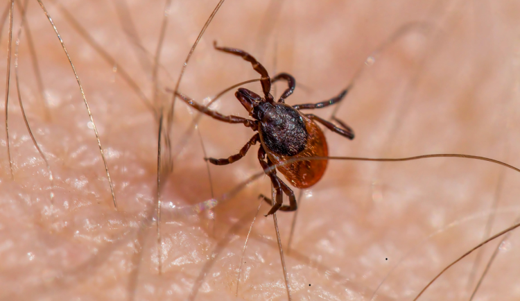 Počet nakažených lymeskou boreliózou stále stoupá. Hygienici už evidují 963 případů