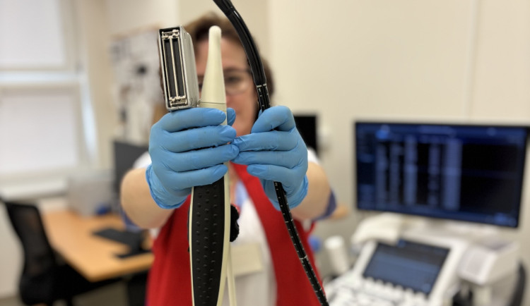 Revoluce v jihlavské nemocnici: Nový přístroj na kardiologii šetří čas i peníze