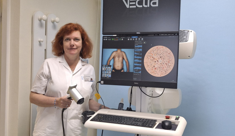 Nechte si zkontrolovat znaménka. Olomoucká poliklinika zve na preventivní akci