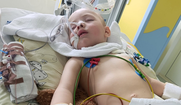 Dvouletý Kristiánek z Prostějova vdechnul hrušku a bojoval o život. S drahou léčbou pomáhá sbírka