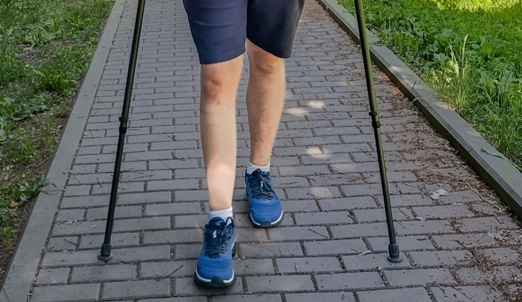 Lékaři z Olomouci umí prodloužit končetinu o několik centimetrů. Používají titanové hřeby