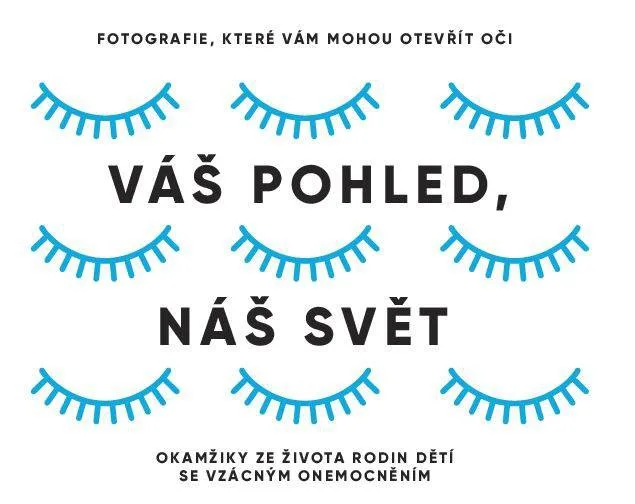 Jedinečná fotografická výstava o dětech se vzácnými chorobami bude k vidění v Pevnosti poznání