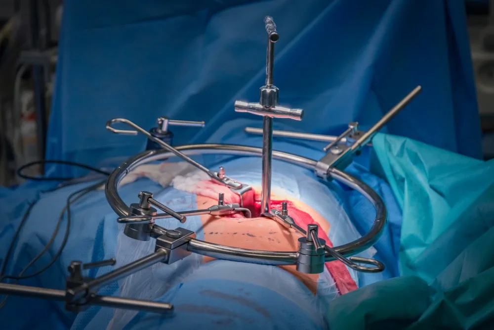 Unikátní meziobratlový implantát, který vymyslel olomoucký primář, už úspěšně pomáhá pacientům