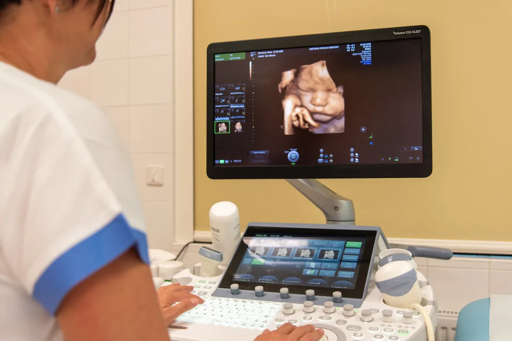 Videozáznam a 3D fotografii miminka si můžete odnést z Fakultní nemocnice Olomouc