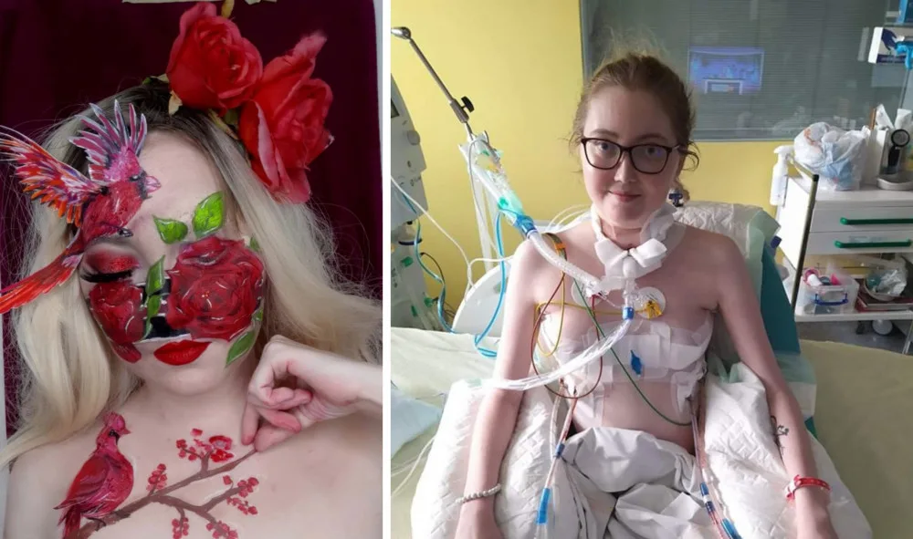 Jsem fénix, který vstal z popela, říká mladá žena po re-transplantaci