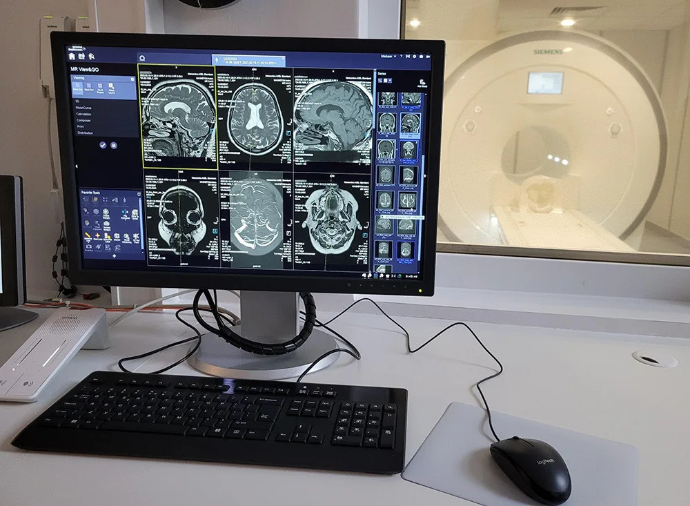 Nová magnetická rezonance ve Šternberku: důležité vyšetření bude v regionu dostupnější