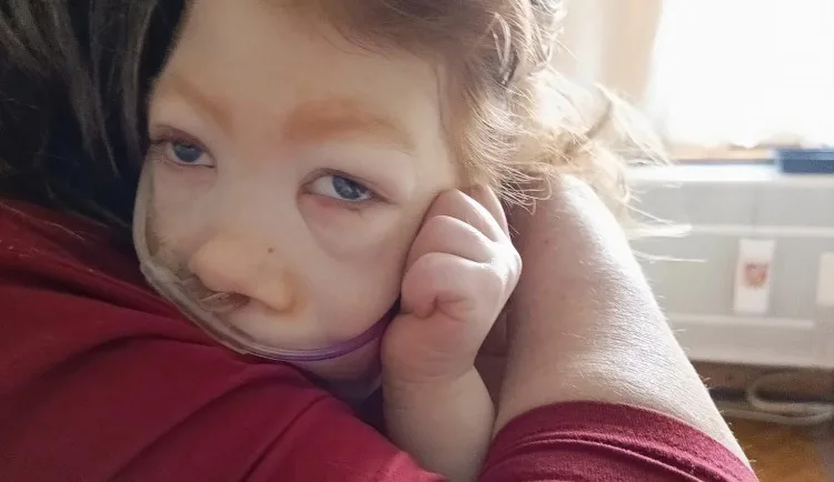 Syn má poškozený mozek a nedožije se rána, řekli Tereze po porodu. Míša teď oslaví tři roky a mamince dává velkou sílu