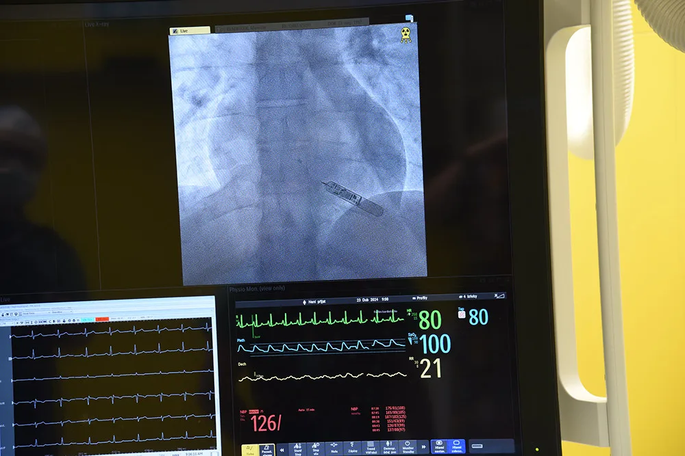 Olomoučtí kardiologové poprvé implantovali pacientovi biomonitor využívající AI. Hlídá srdce mladého řidiče