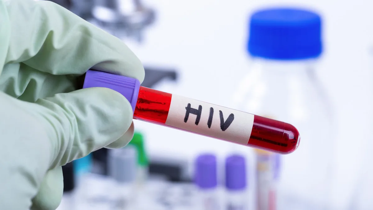 HIV_ilustracni