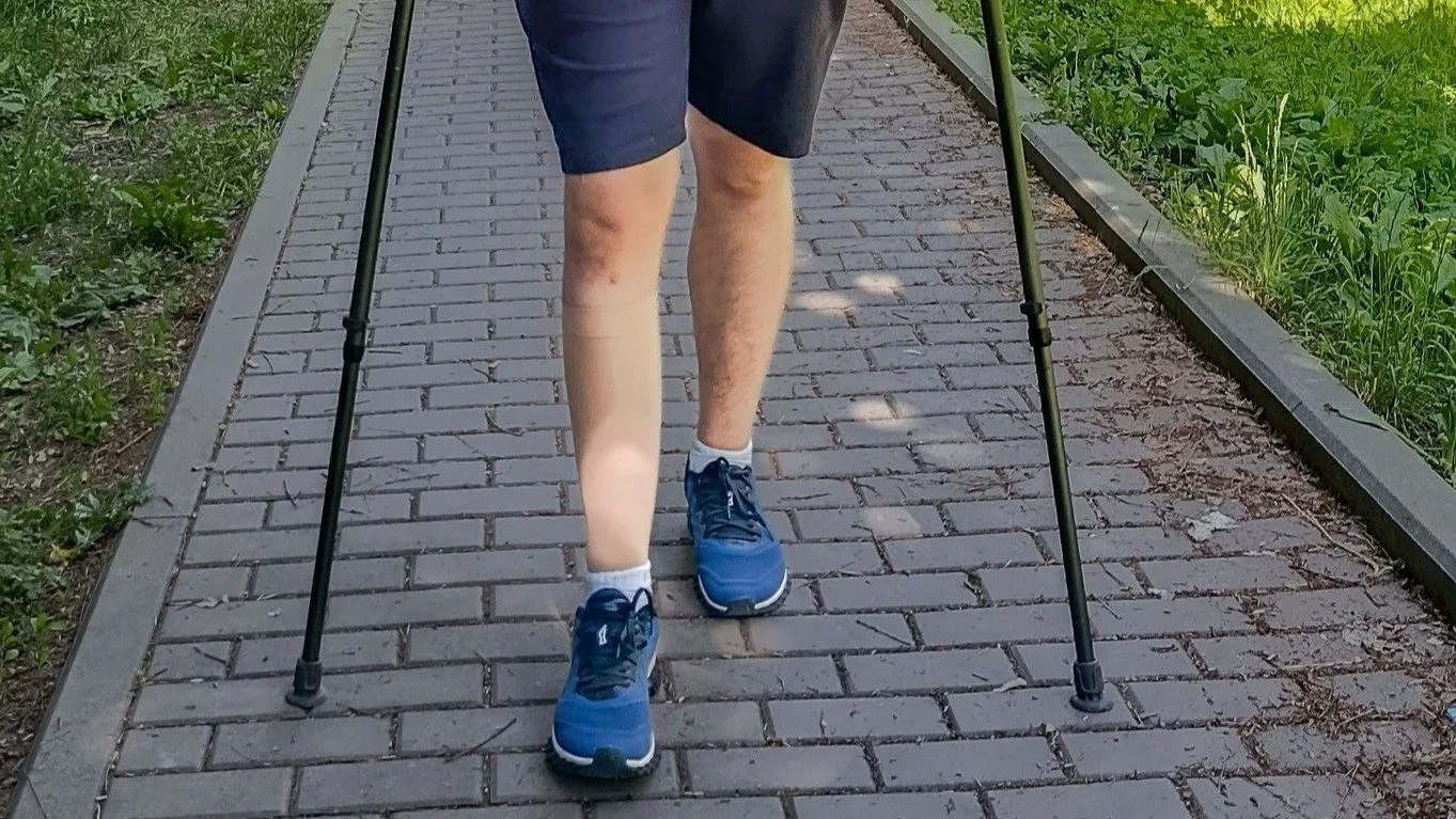 Lékaři z Olomouci umí prodloužit končetinu o několik centimetrů. Používají titanové hřeby