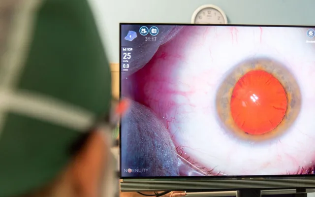 Nový operační systém usnadní jemnou práci lékařů z olomoucké oční kliniky