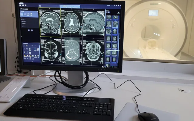 Nová magnetická rezonance ve Šternberku: důležité vyšetření bude v regionu dostupnější